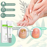 Flyles Nail Repair Gel for Damaged Nails, 2 Pack