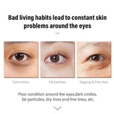Caffeine Brightening Eye Cream - Caffeine Anti-Aging, Dark Circle Eye Bags, Niacinamide, Retinol, Squalane, Peptides, K-beauty