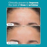 Paula's Choice 6% Mandelic Acid + 2% Lactic Acid Exfoliant - 30ml | Gentle Daily AHA Exfoliation for Sensitive Skin