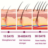 Advanced Natural Hair Growth Oil & Scalp Serum (50ML) - Treatment for Thinning Hair & Dry Itchy Scalp