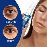 Dark Circle Reducing Eye Cream, 30g – Tired Eye Relief, Tightening & Hydration for Puffy Eyes & Bags