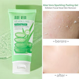 Aloe Vera Peeling Gel - Sparkling Facial Scrub for Deep Cleansing & Gentle Exfoliation | All Skin Types