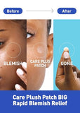 OLIVE YOUNG Care Plus Spot Patch - Hydrocolloid Acne Pimple Patch (510 Count, Pack of 5)