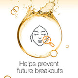 Neutrogena Spot Controlling Oil-Free Facial Wash - Clinically Proven Formula for Clear Skin, 200ml