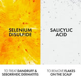 Vichy Dercos Anti-Dandruff Shampoo (Normal to Oily Hair) - 390ml