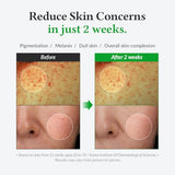 Dr.Althea Vitamin C Boosting Serum & Gentle Vitamin C Serum - Sensitive Skin Friendly, Even Skin Tone, Pigmentation Treatment (Gentle Vitamin C)