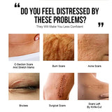 Advanced Scar Removal Cream - Accelerate Wound Healing & Repair Collagen Fibers