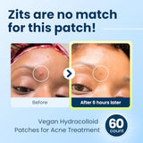 CLEAN SKIN CLUB 60 Invisible Vegan Pimple Patches - Non-Toxic & Absorbing