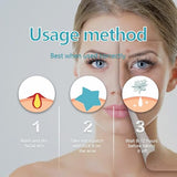 POSICHE Hydrocolloid Acne Patches 216 Pieces - Clean, Clear & Conceal Blemishes