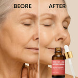 PDRN 120,000 ppm EGF Peptide Microneedling Serum – Anti-Aging with Volufiline, Salmon DNA & Phyto PDRN 12% 1 Fl Oz