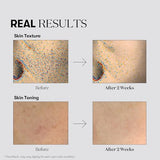 VT COSMETICS TX Toning Toner: Brightening & Hydrating Toner for Sensitive Skin