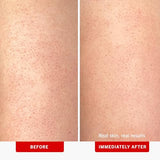 First Aid Beauty KP Bump Eraser Exfoliating Body Scrub with 10% AHA, 56g