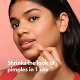 Hero Cosmetics Mighty Patch Hydrocolloid Acne Absorbing Spot Dot