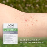 ACM Molutrex 5% Potassium Hydroxide (3ml) - Keratolytic Treatment