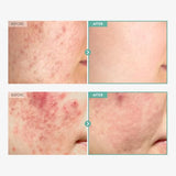 Dexpanthenol & Centella Asiatica Barrier Repair Cream | Sensitive Skin Moisturizer