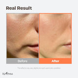 ISNTREE Green Tea Fresh Toner - Pore & Sebum Care for Sensitive & Oily Skin