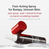 Medicube Red Body Peeling Shot - Strawberry Skin Exfoliating Spray with AHA, BHA & Succinic Acid - 3.88 oz