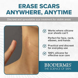 Xeragel Professional Silicone Scar Ointment - 10g Clinical Formula