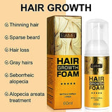 Hair Growth Foam & Serum for Men & Women - Anti-Hair Loss Treatment 60ml