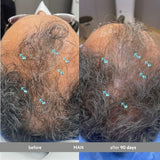 DS Laboratories Spectral.DNC-S Extra Strength Leave-In Serum – Hair Loss & Thinning Support for Men & Women, 60ml