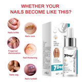 Nail Fungus Treatment Essence - Fungal Nail Repair for Toes & Ingrown Nails (20ml)