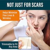 NUVADERMIS Silicone Scar Tape for Surgical Scars, 120x1.5 Roll