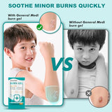 General Medi Cooling Burn Gel Packets - 25 Count First Aid Care