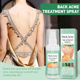 Azonee Back Acne Treatment Spray - Tea Tree, Salicylic Acid, 2% Aloe, 4 oz