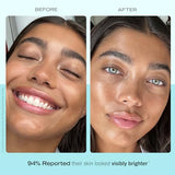 First Aid Beauty Ultra Repair Hydrating Moisturizer with Niacinamide - Rich Moisture, Sensitive Skin Friendly, 1.7 oz