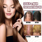 Premium Red Onion Hair Oil & Thickening Spray - 30ml | Anti-Hair Loss & Rapid Growth for Men & Women