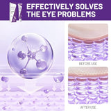 Retinol & Niacinamide Eye Cream for Fine Lines, Wrinkles & Dark Circles