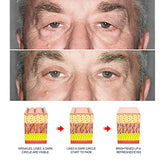 Retinol Under Eye Cream for Dark Circles, Puffy Eyes & Fine Lines - Fade Wrinkles & Improved Skin Texture