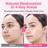 Numbuzin No.2 Rose PDRN Collagen Plumping Sheet Mask – 4ea | Korean Face Mask for Brightening and Hydration