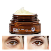Retinol Eye Cream with Hyaluronic Acid & Vitamin E, Fast-Acting Dark Circle & Fine Line Reducer