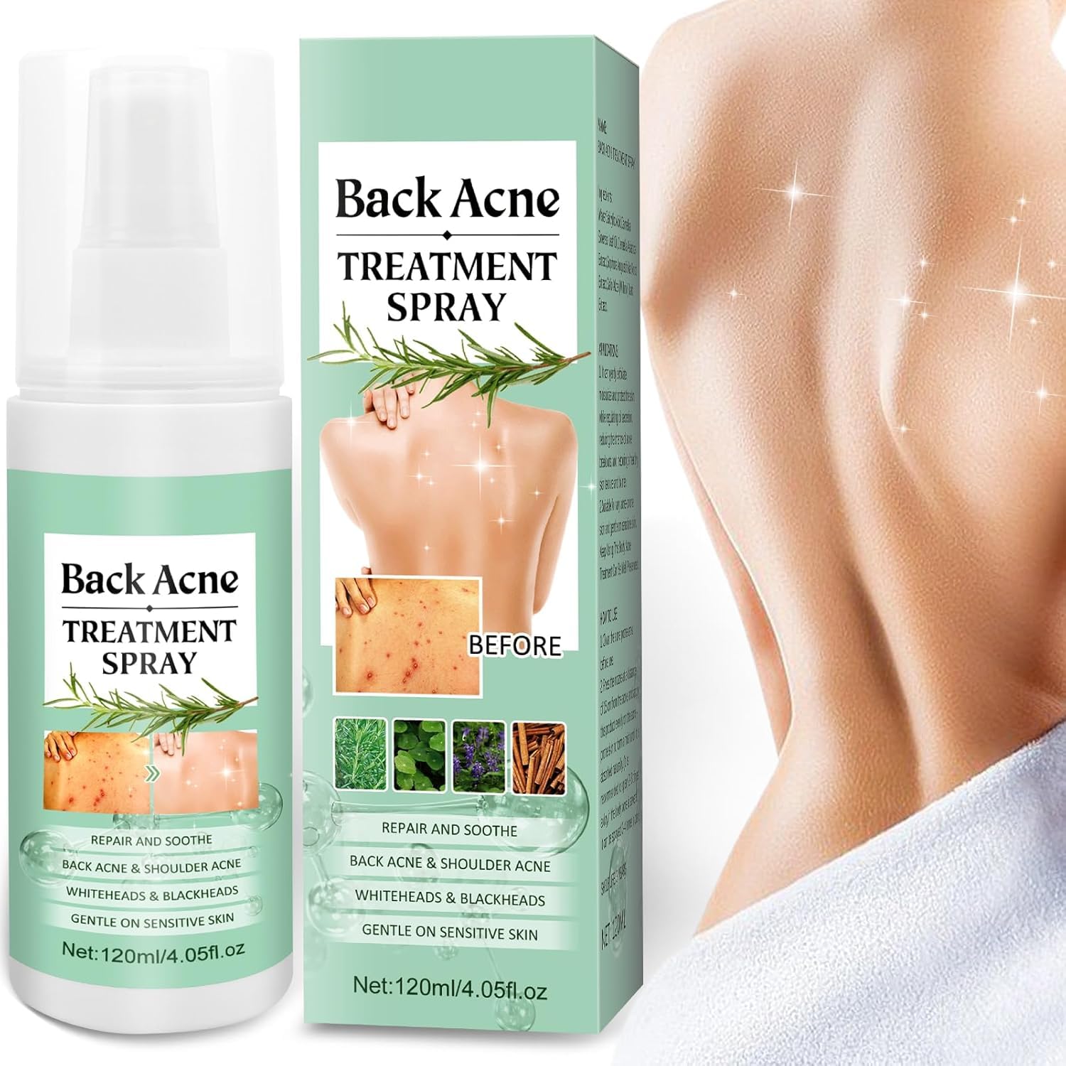 Azonee Back Acne Treatment Spray - Tea Tree, Salicylic Acid, 2% Aloe, 4 oz