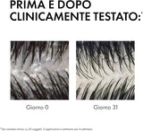 Vichy Dercos Anti-Dandruff Shampoo for Normal to Oily Hair (200ml)