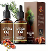 Organic Batana Oil with Rosemary - 100% Natural Hair Growth Treatment - 2-Pack (30ml/1 Fl Oz Each)