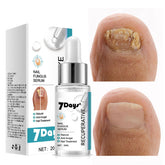 Nail Fungus Treatment Essence - Fungal Nail Repair for Toes & Ingrown Nails (20ml)