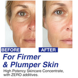 100% Pure Volufiline Concentrate Mix-in Serum - Skin Firming Solution & Clinically Proven | Anti-Wrinkle, Enhances Facial Contours, Boosts Collagen for Sagging Mature Skin Korean Skincare