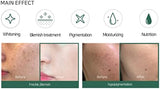 SOME BY MI Yuja Niacin 30-Day Blemish Care Serum - 50ml