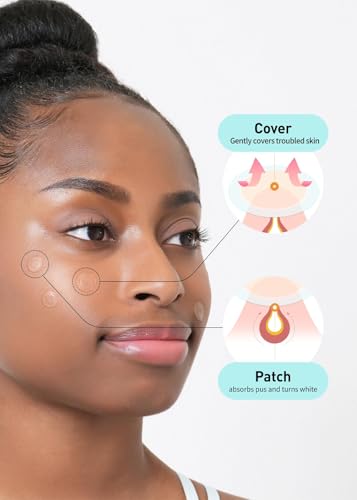 OLIVE YOUNG Care Plus Spot Patch - Hydrocolloid Acne Pimple Patch for Face & Blemishes (102 Count)