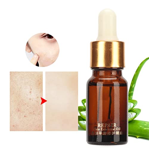 10ml Skin Care Serum with Essential Oils - Hydrating & Nourishing Facial Treatment