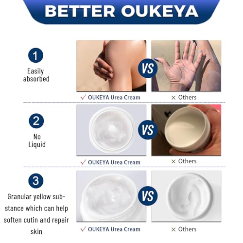 OUKEYA Urea Cream 42% + Salicylic Acid 2% - 350g for Dry Cracked Feet