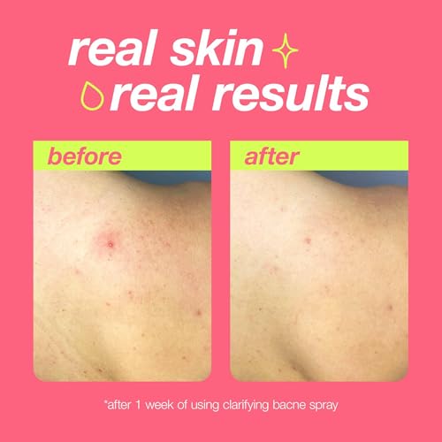 Dermalogica Clear Start Clarifying Bacne Spray, Body & Back