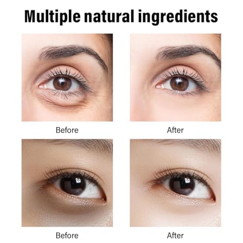 Retinol Eye Cream for Dark Circles and Puffiness - Wrinkle Cream and Brightening Solution, 30g