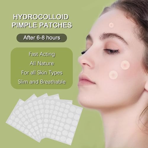 Sawanork Pimple Patches for Face - 216 Count Hydrocolloid Acne Stickers (2 Sizes)