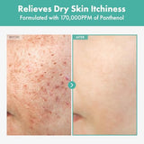 Dexpanthenol & Centella Asiatica Barrier Repair Cream | Sensitive Skin Moisturizer