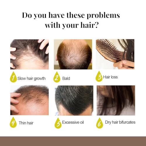 Advanced Natural Hair Growth Oil & Scalp Serum (50ML) - Treatment for Thinning Hair & Dry Itchy Scalp