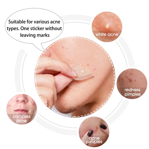 Hydrocolloid Acne Patch (20 Patches) - Large Spot Control Cover for Body, Cheek, Forehead, and Chin