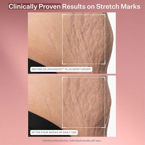 StriVectin SD Advanced Plus Intensive Moisturizer - Wrinkle & Stretch Mark Reduction